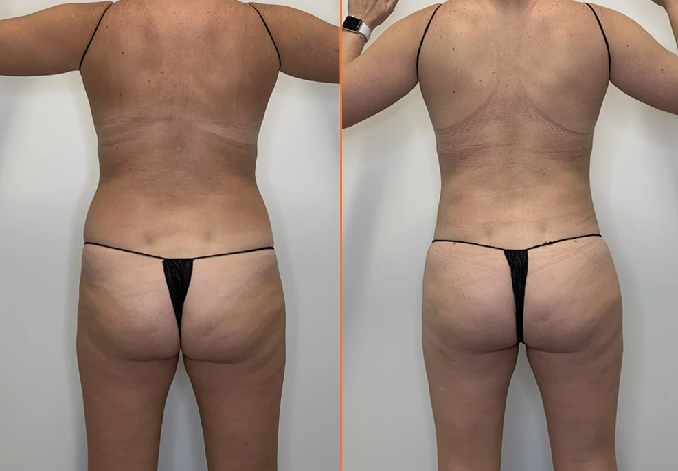 24-back1