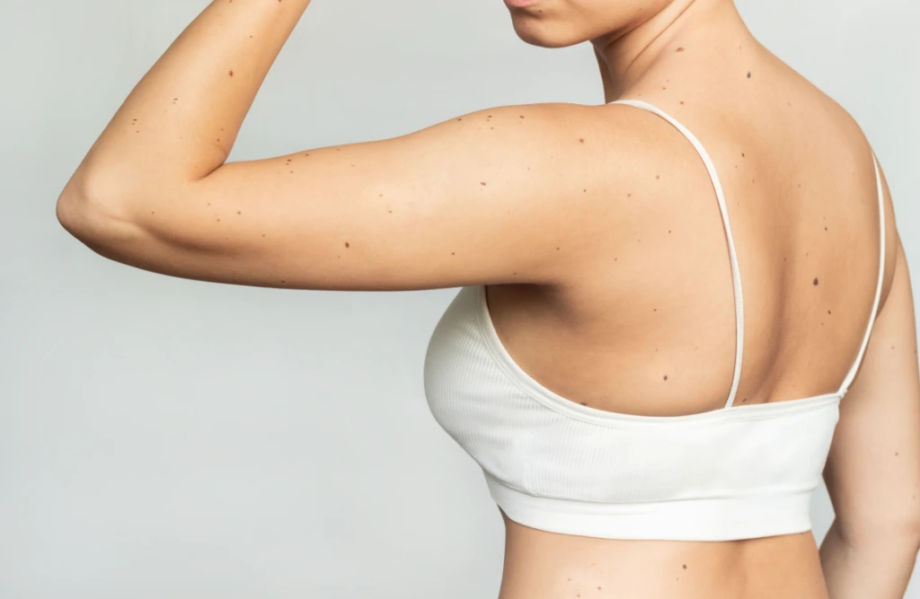 What is Non-Surgical Arm Lift? Banner