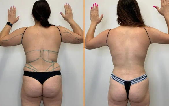 before & after Slim & Tight Results Banner