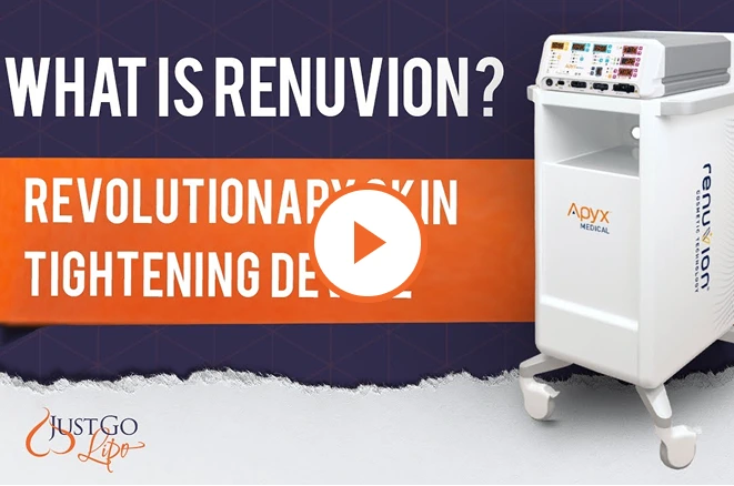 Keep Your Results Longer With Renuvion video thumbnail