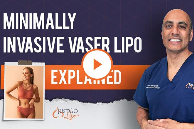 What Is Lipo 360? Video Thumbnail